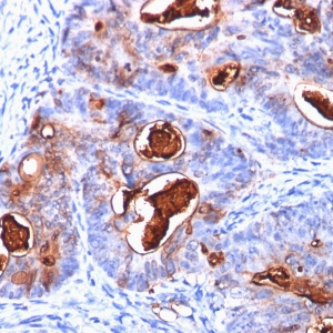 Carcinoembryonic Antigen (CEA) / CD66; Clone C66/1260 (Concentrate)